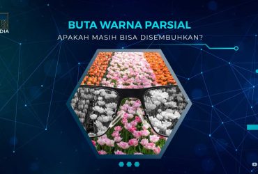 Apakah Buta Warna Parsial Bisa Disembuhkan