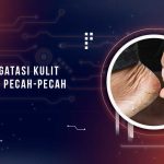 Solusi Kulit Kaki Pecah-Pecah