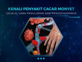 Penyakit Mpox (Cacar Monyet)