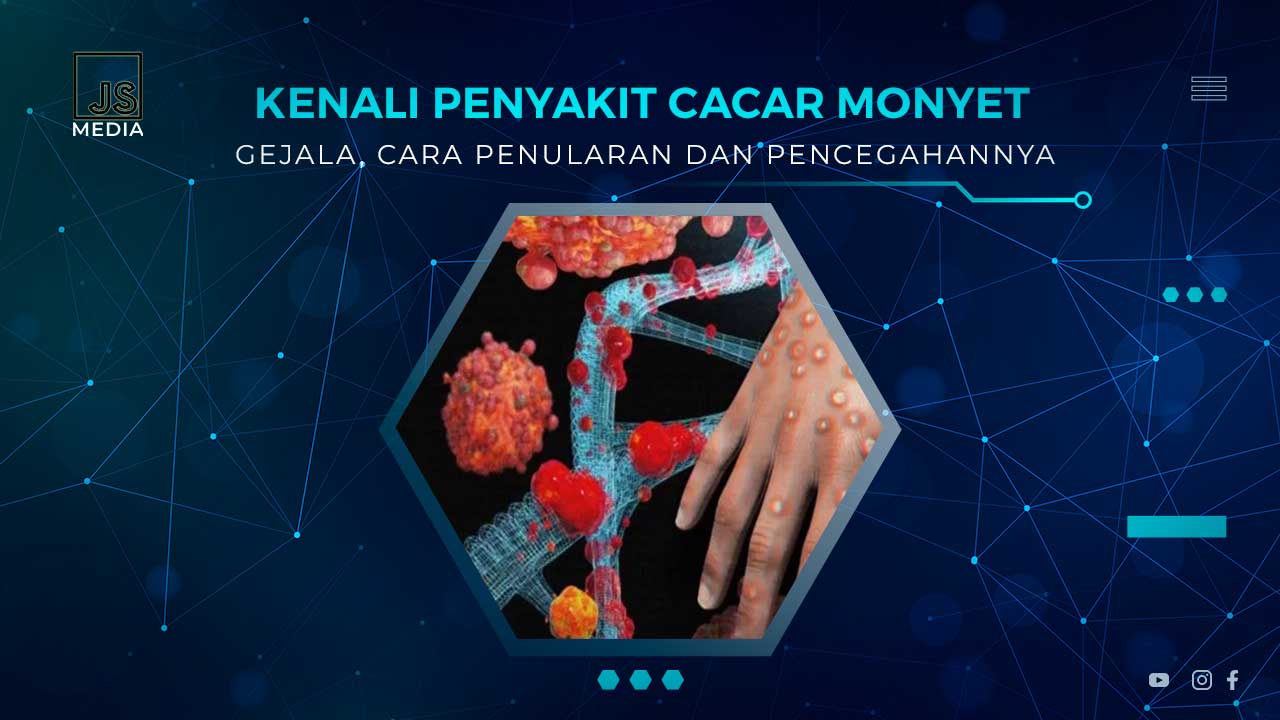 Penyakit Mpox (Cacar Monyet)